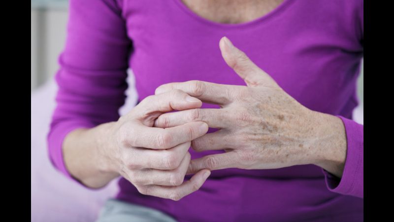 Treating Arthritis